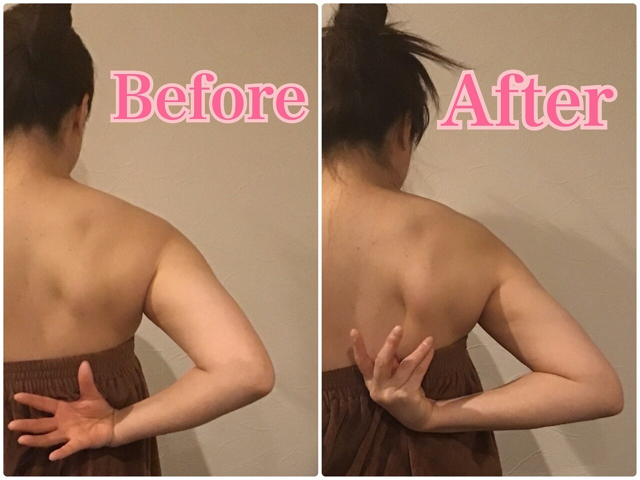 施術前後の比較 2