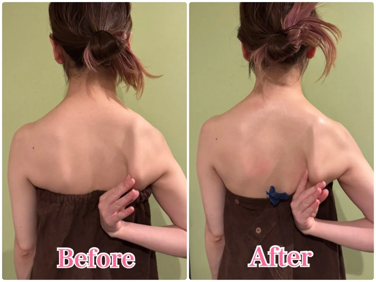 施術前後の比較 3